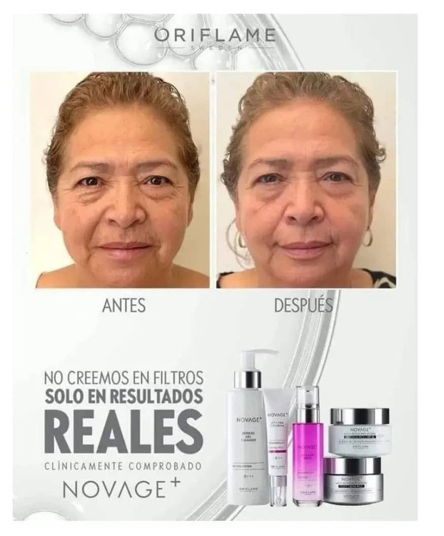 ست نوویج لیفت پلاس